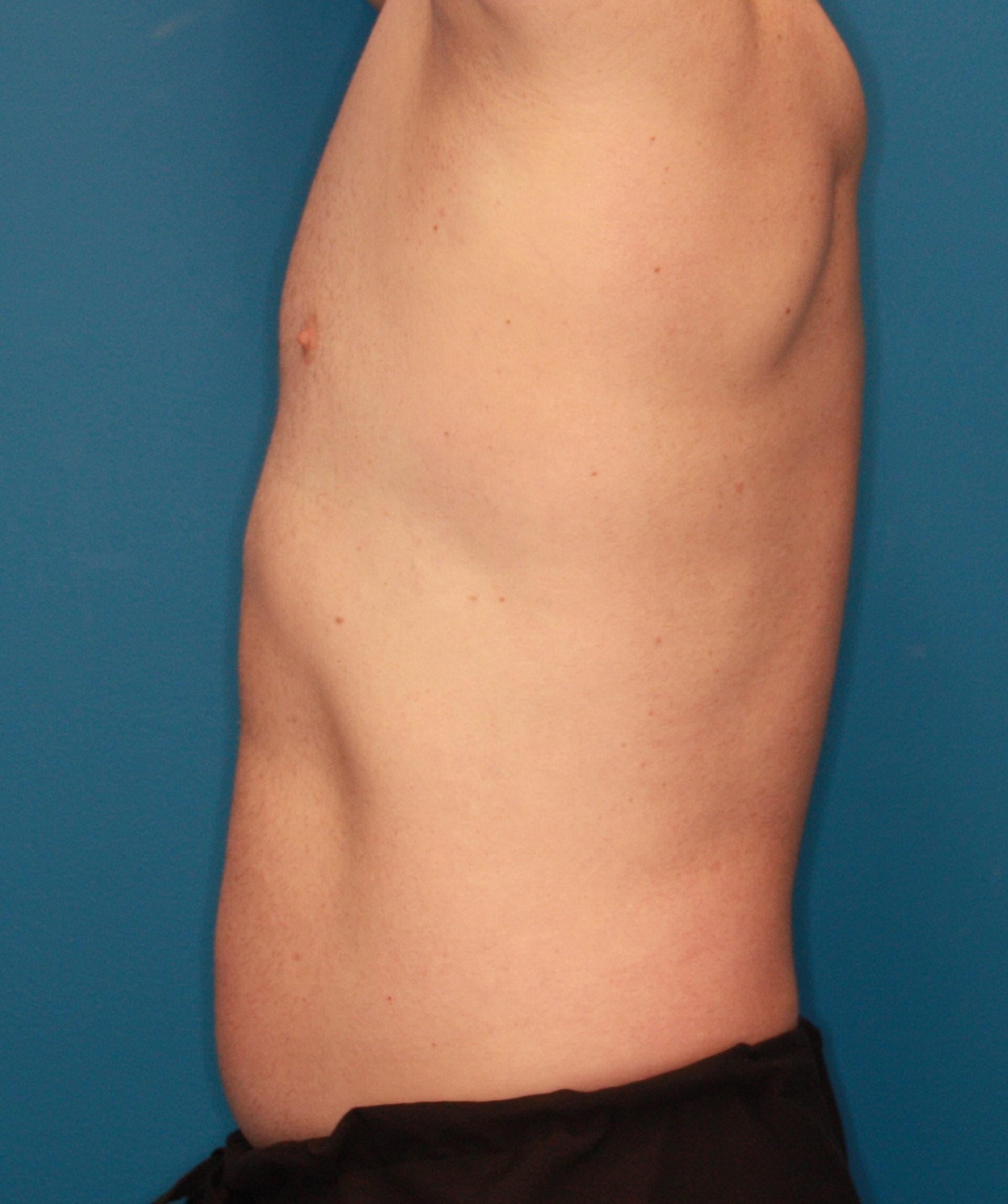 Body case #180 after, image 3