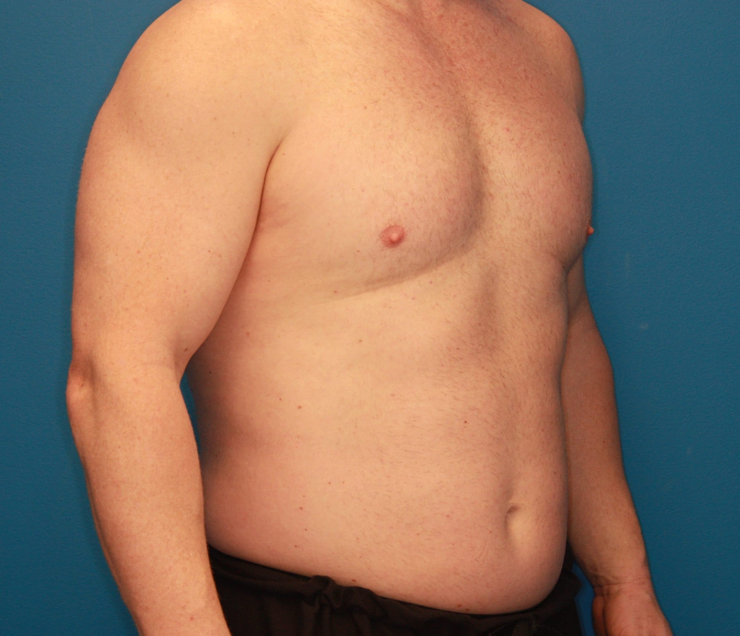 Body case #180 after, image 4