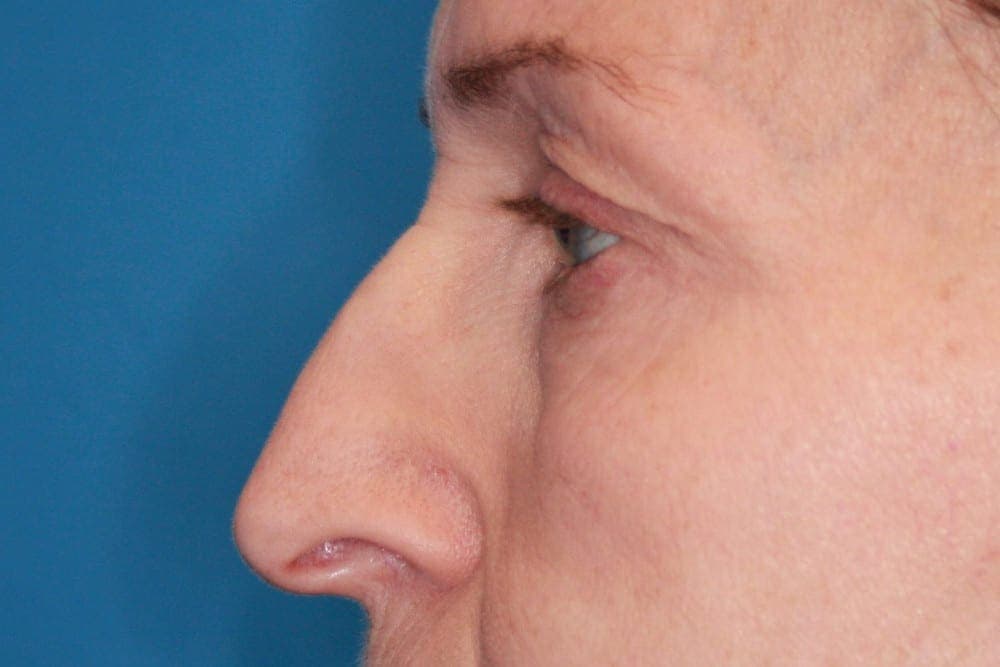 Face case #160 before, image 2