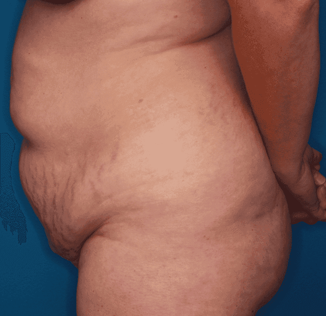 Body case #158 before, image 3