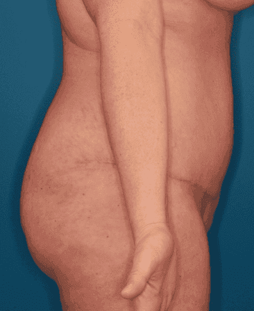 Body case #158 after, image 4