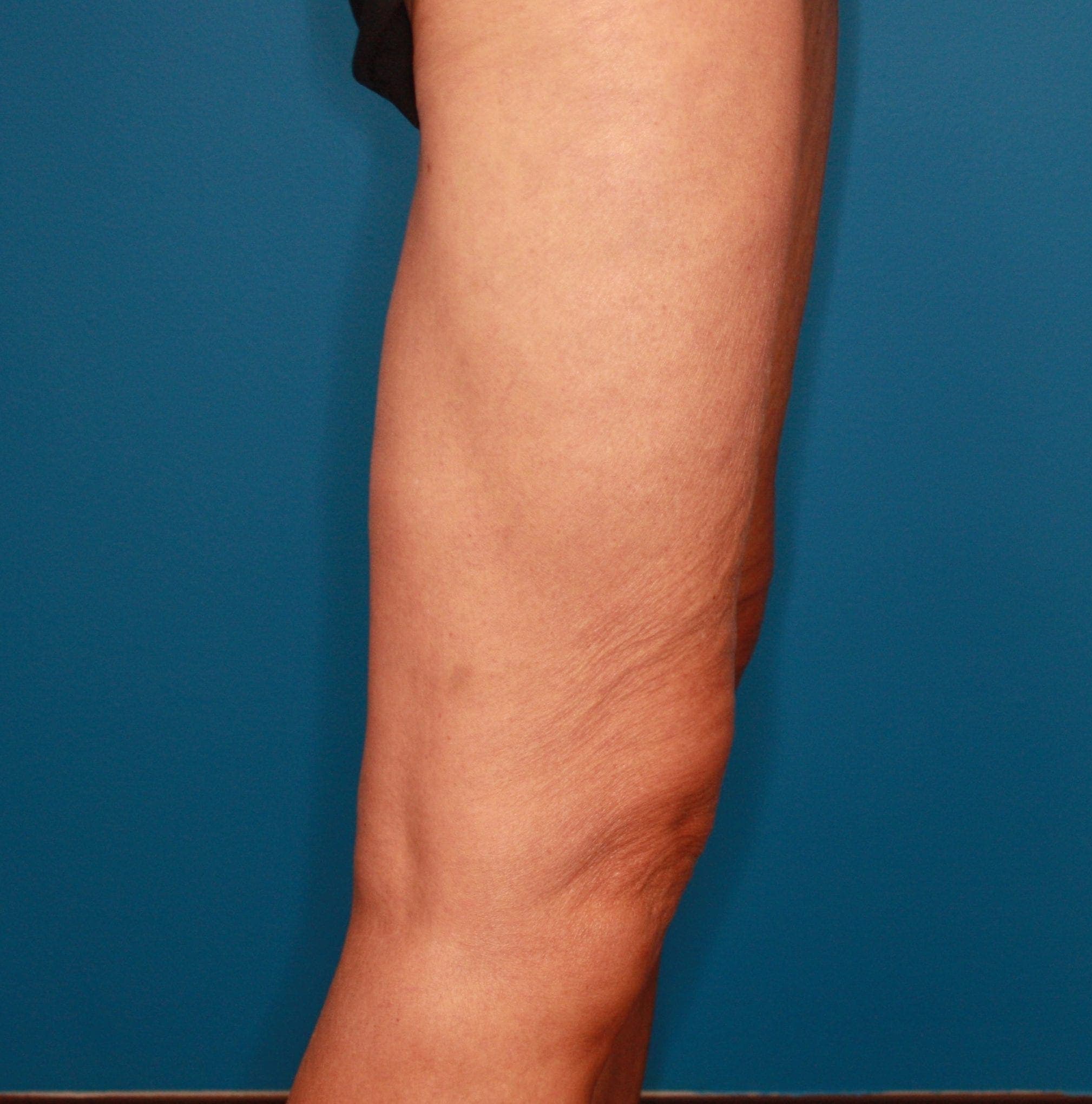 Body case #200 after, image 3