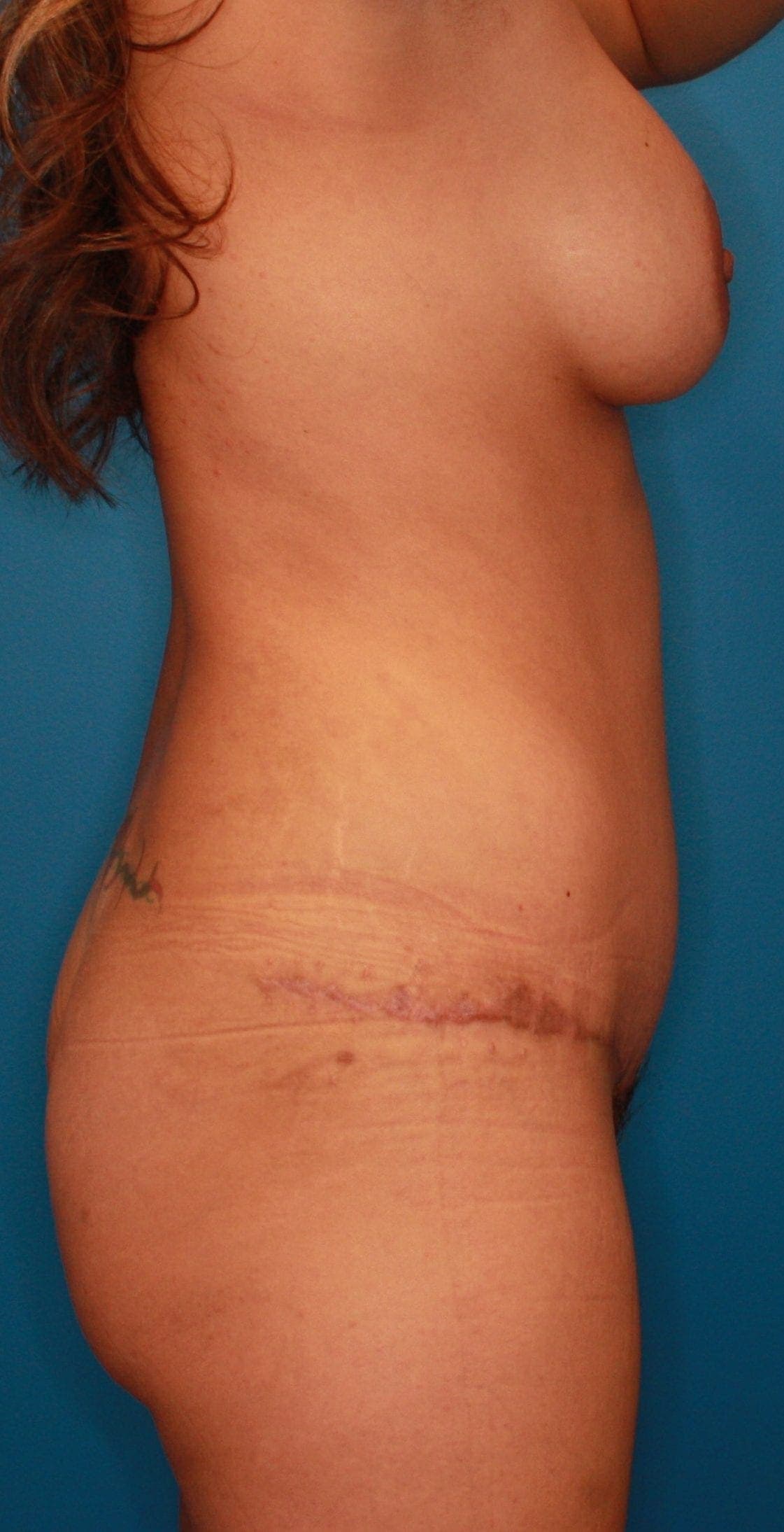 Body case #150 after, image 4