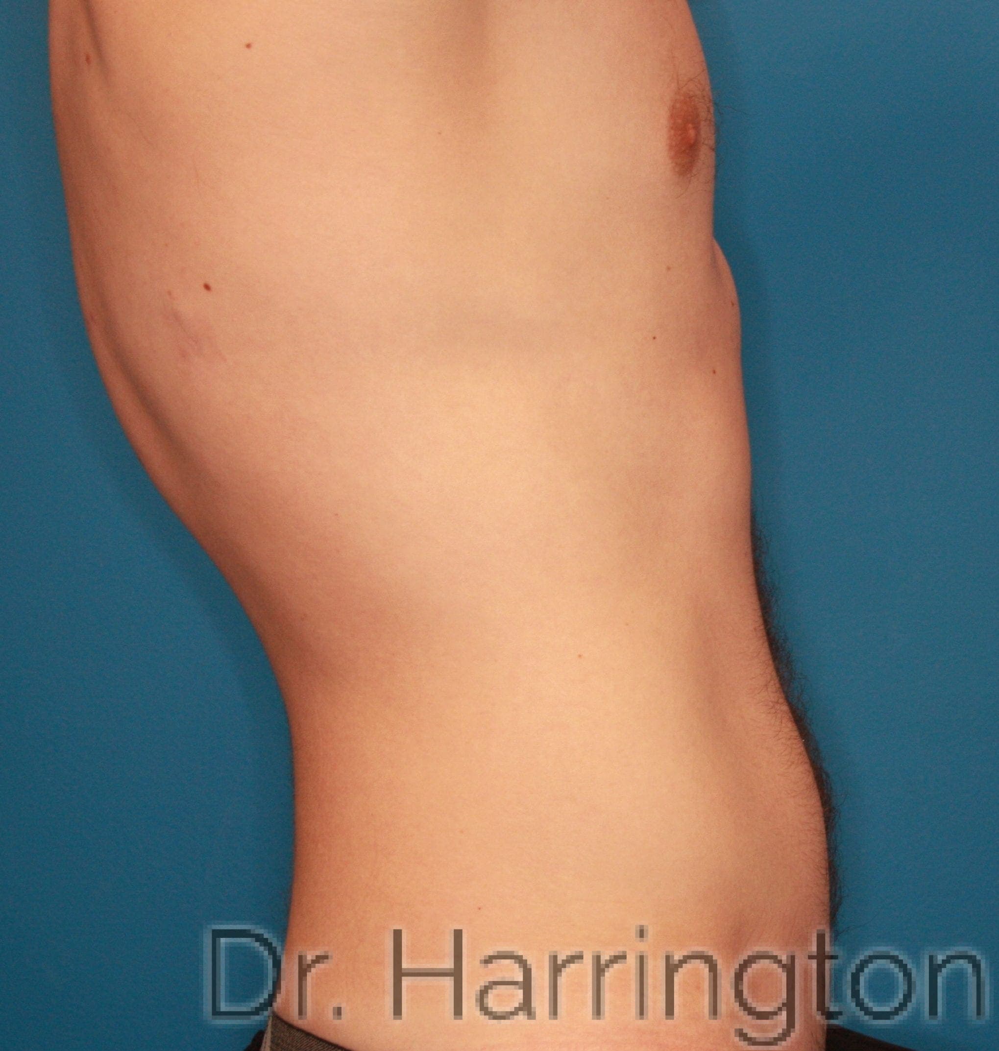 Body case #154 after, image 3