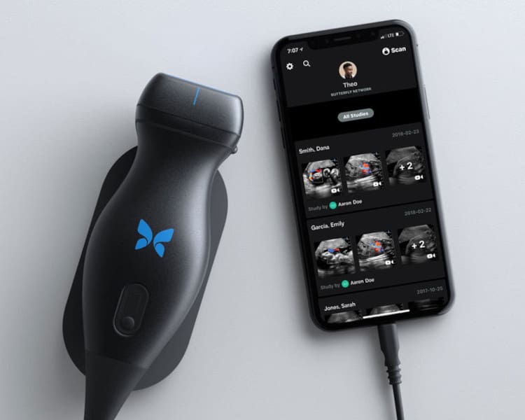 Butterfly iQ Device