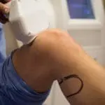 CoolSculpting® for Men img 3