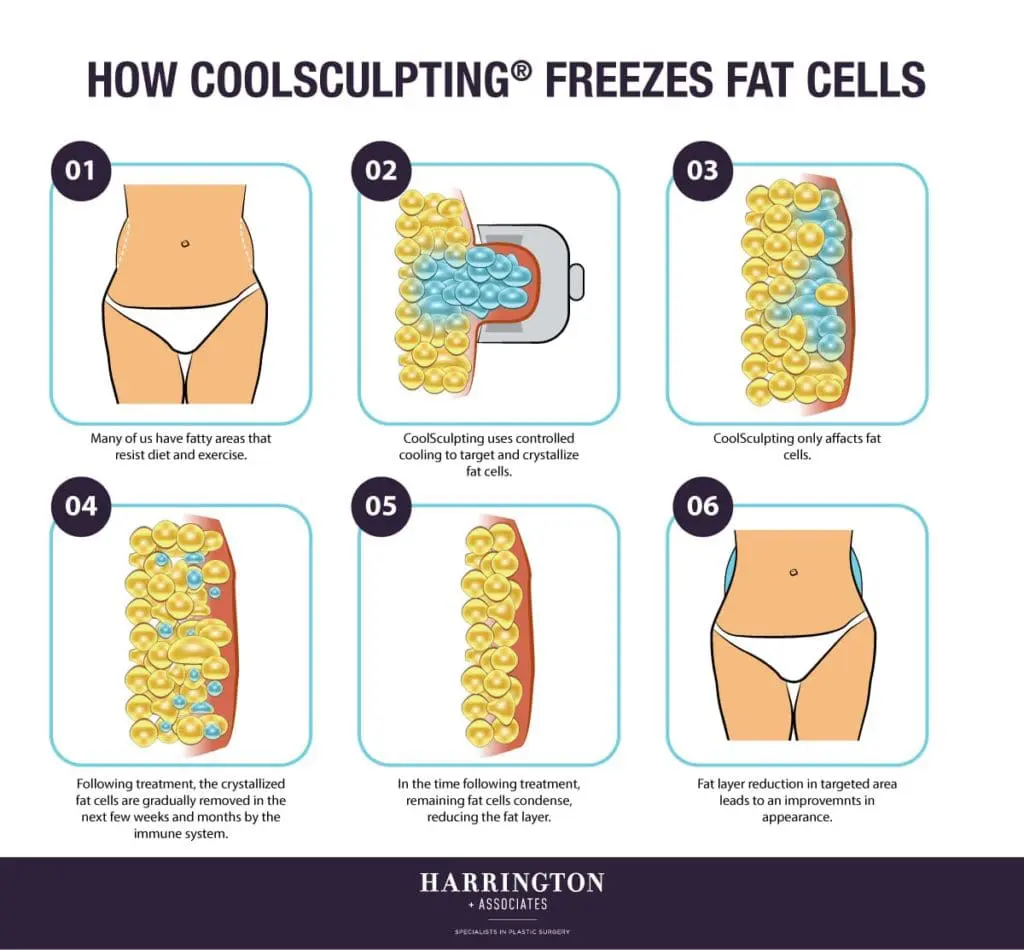 Here’s the Skinny on How to Look Slimmer This Spring img 2