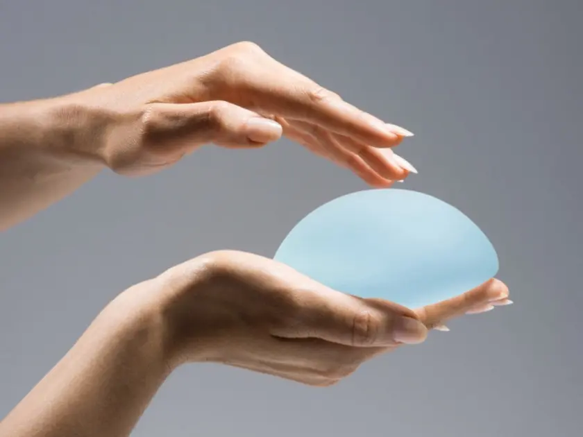 Motiva Breast Implants