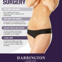 What to Expect After Breast Reduction Surgery [Infographics]