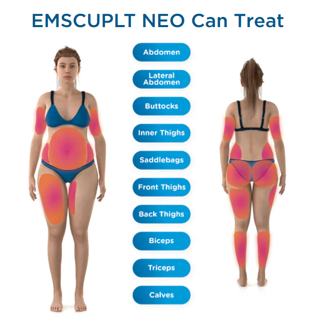 Emsculpt Neo treatment areas